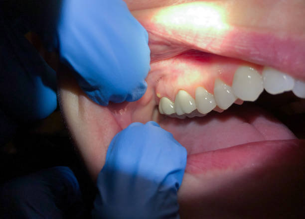 Best Emergency Gum Pain Relief  in Mulvane, KS