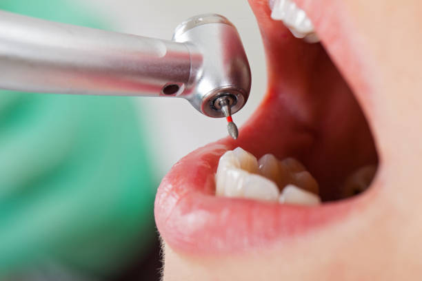 Best Teeth Whitening  in Mulvane, KS